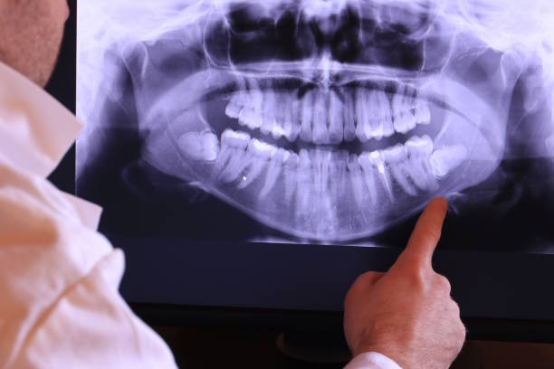 Best Emergency Dentist for Special Needs Patients in Raleigh, NC