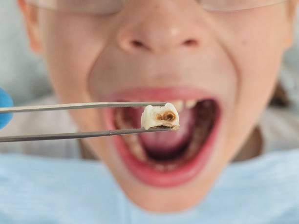 Best Mobile Emergency Dentist in Raleigh, NC
